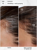 FutureIQ™ biomimetic hair longevity serum