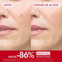 Liftactiv B3 Serum for Dark Spots